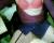 Coralie 2